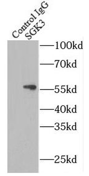 SGK3 Antibody