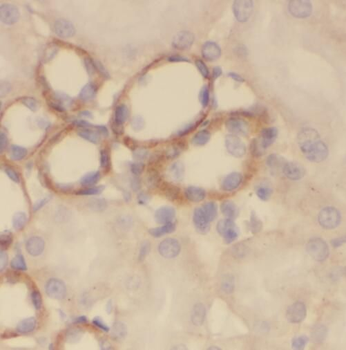 SLC5A2 Rabbit Polyclonal Antibody