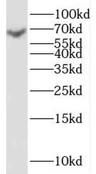 SGO1 Rabbit Polyclonal Antibody
