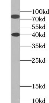 SH2B1 Rabbit Polyclonal Antibody