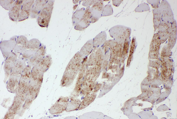 SH2B1 Rabbit Polyclonal Antibody