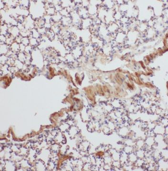 SH2D1A Rabbit Polyclonal Antibody