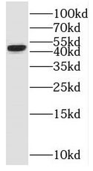 SH2D5 Rabbit Polyclonal Antibody