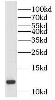 SH3BGRL2 Rabbit Polyclonal Antibody