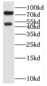 SH3BP1 Rabbit Polyclonal Antibody