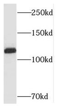SH3BP4 Rabbit Polyclonal Antibody