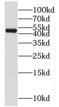 SH3D19 Rabbit Polyclonal Antibody