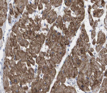 SH3D19 Rabbit Polyclonal Antibody