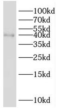 SH3GL2 Rabbit Polyclonal Antibody