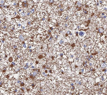 SH3GL2 Rabbit Polyclonal Antibody