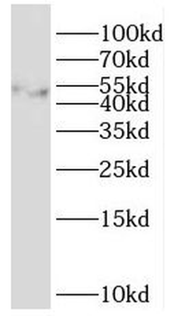 SH3GLB2 Antibody