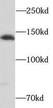 SH3PXD2A Rabbit Polyclonal Antibody