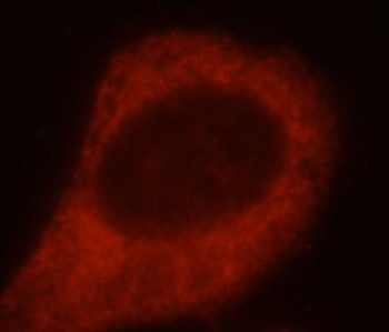 SH3PXD2A Rabbit Polyclonal Antibody