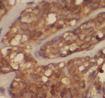 SH3PXD2A Rabbit Polyclonal Antibody