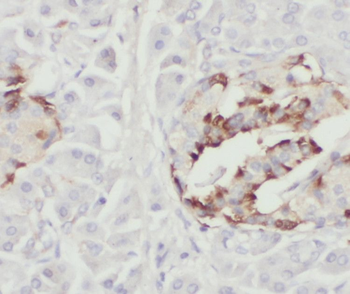 SHC3 Rabbit Polyclonal Antibody