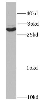 SIAH1 Rabbit Polyclonal Antibody