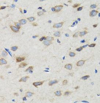 SIAH1 Rabbit Polyclonal Antibody