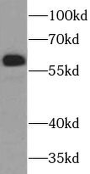 SIM2 Rabbit Polyclonal Antibody
