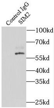 SIM2 Rabbit Polyclonal Antibody