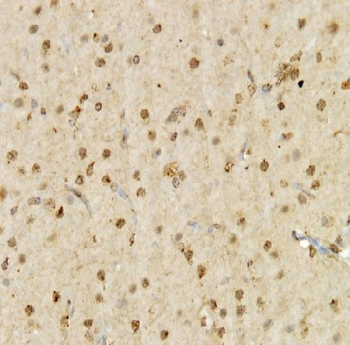 SIM2 Rabbit Polyclonal Antibody