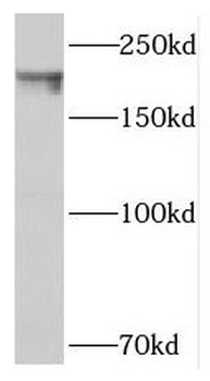 SIPA1L1 Rabbit Polyclonal Antibody