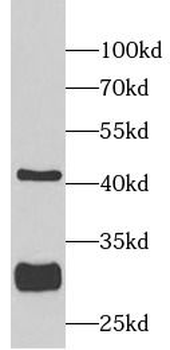 SIRT3 Antibody