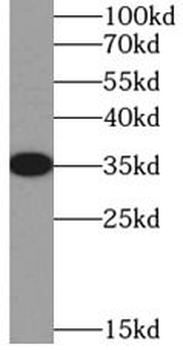 SIX2 Rabbit Polyclonal Antibody