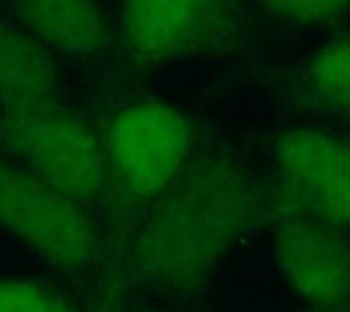 SIX2 Rabbit Polyclonal Antibody