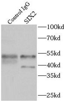SIX2 Rabbit Polyclonal Antibody