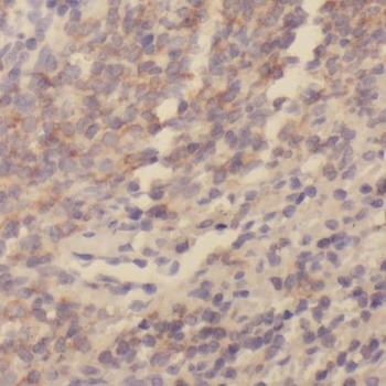 SKAP1 Antibody