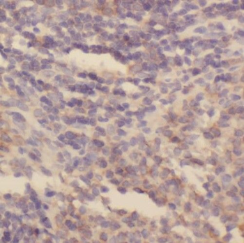 SKAP1 Antibody