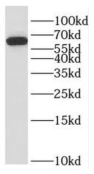 SLAIN2 Rabbit Polyclonal Antibody