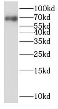 SLC11A2 Antibody