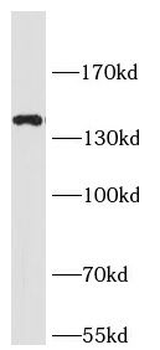 SLC12A2 Rabbit Polyclonal Antibody