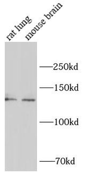 SLC12A2 Rabbit Polyclonal Antibody