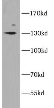 SLC12A4 Rabbit Polyclonal Antibody