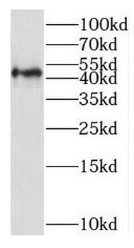 SLC16A12 Rabbit Polyclonal Antibody