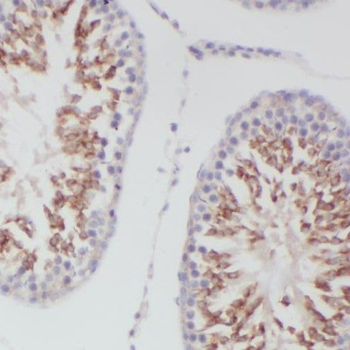 SLC16A12 Rabbit Polyclonal Antibody