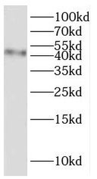 SLC17A5 Rabbit Polyclonal Antibody