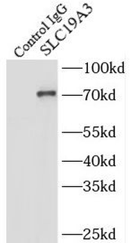 SLC19A3 Rabbit Polyclonal Antibody