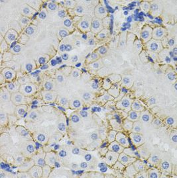 SLC1A4 Rabbit Polyclonal Antibody
