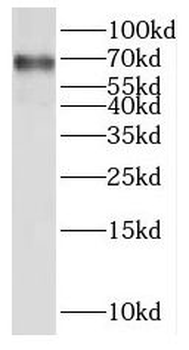 SLC20A2 Rabbit Polyclonal Antibody