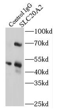 SLC20A2 Rabbit Polyclonal Antibody