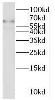 SLC22A1 Rabbit Polyclonal Antibody