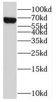 SLC22A2 Rabbit Polyclonal Antibody