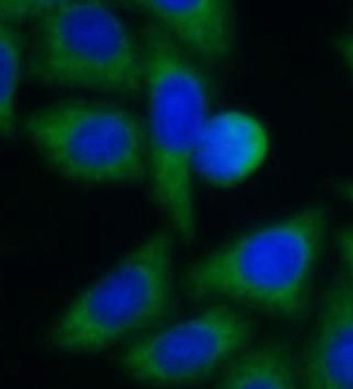 SLC25A1 Antibody
