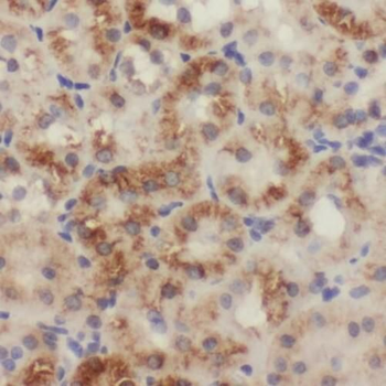 SLC25A1 Antibody