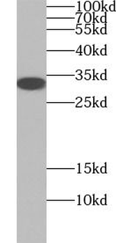 SLC25A10 Rabbit Polyclonal Antibody