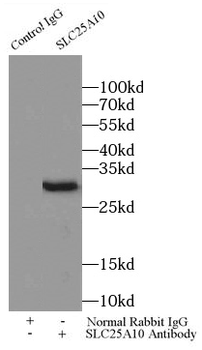 SLC25A10 Rabbit Polyclonal Antibody