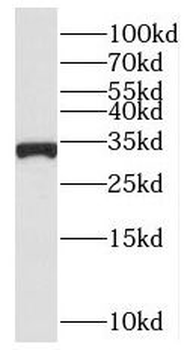 SLC25A11 Rabbit Polyclonal Antibody